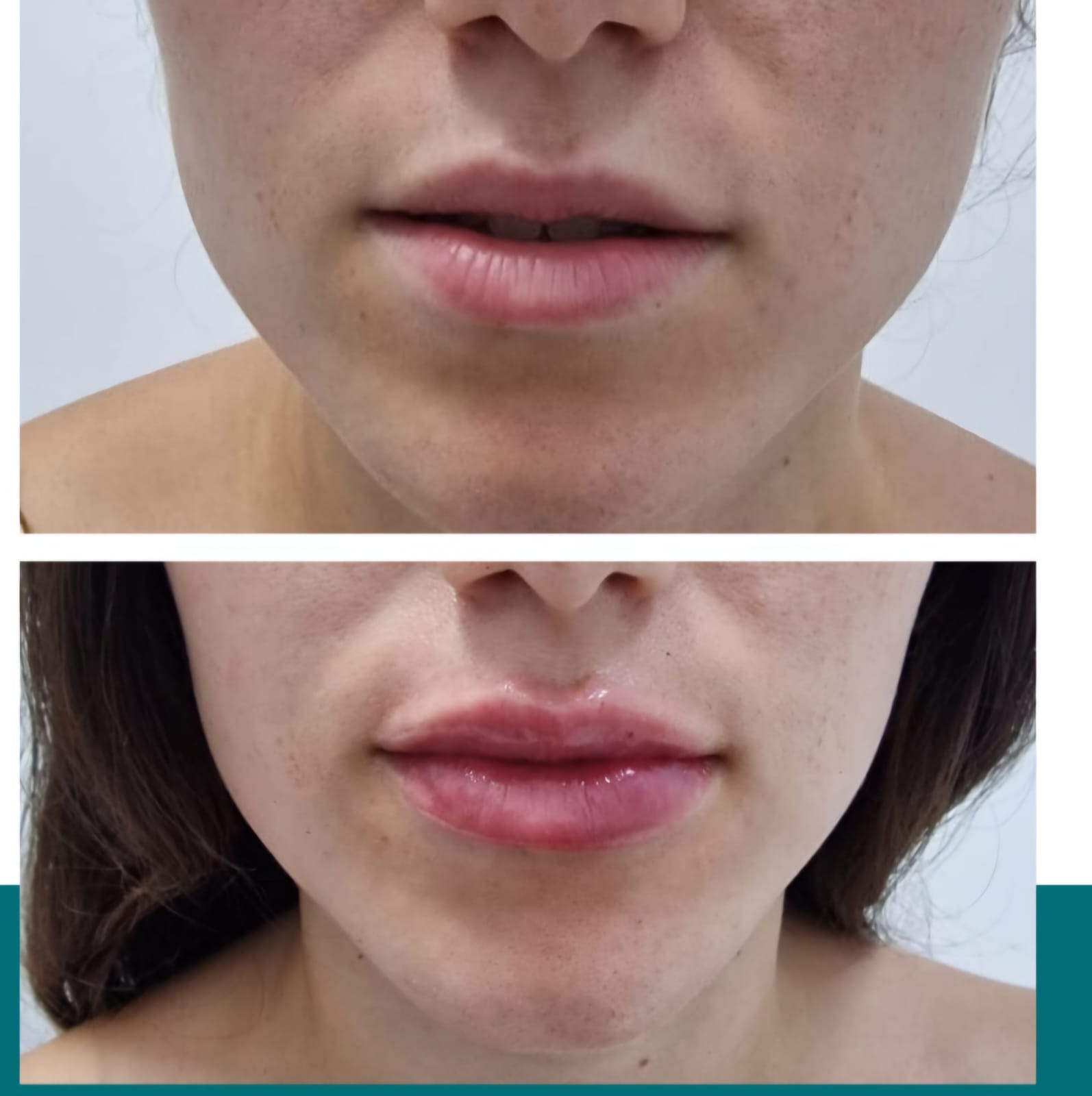 Resultado real: antes y después del tratamiento